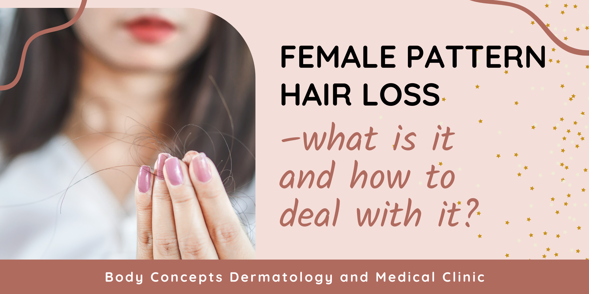 Female pattern hair loss –what is it and how to deal with it | Body Concepts Dermatology and Medical Clinic | Dr. Pag-asa Bernardo-Bagolor | San Rafael, Bulacan