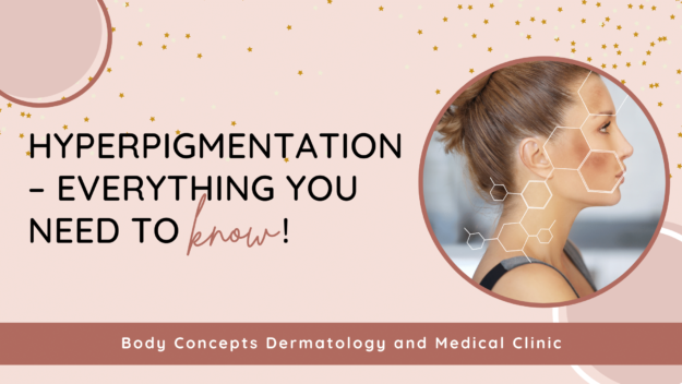 Hyperpigmentation – everything you need to know! | Body Concepts Dermatology and Medical Clinic | Dr. Pag-asa Bernardo-Bagolor | San Rafael, Bulacan