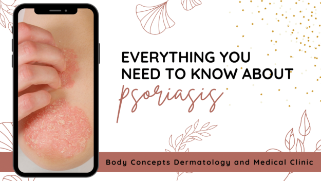 Everything you need to know about psoriasis | Body Concepts Dermatology and Medical Clinic | Dr. Pag-asa Bernardo-Bagolor | San Rafael, Bulacan